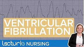 Ventricular Fibrillation: ECG Interpretation & Presentation