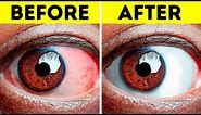 10+ Easy Exercises to Relieve Tired Eyes
