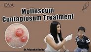 How to treat Molluscum Contagiosum? | Treatment of viral skin infection | Dr. Priyanka Reddy