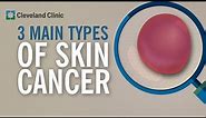 3 Types of Skin Cancer