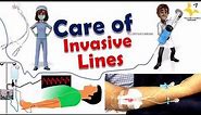 Care of invasive lines- ICU