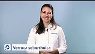 Verruca seborrhoica (Alterswarzen) - Ursachen, Symptome und Behandlung | dermanostic Hautlexikon