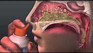 Can Saline Irrigation Help Nasal Allergies? Animated Guide to Saline Nasal Irrigation.