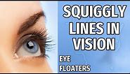 Squiggly Lines In Vision - What Causes Floaters In Your Eyes?
