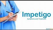 Impetigo ¦ Treatment and Symptoms