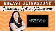 Breast Ultrasound- Sebaceous Cyst (Sonography in Seconds Series)