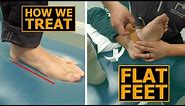 How We Treat Flat Feet | Collapsed Arches | Physical Therapy