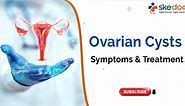 Ovarian Cysts: Symptoms and Treatment | Skedoc