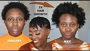 The Only Protective Style That Doubled My 4C Hair Growth - Twists