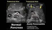Pancreas Ultrasound Normal Vs Abnormal Image Appearances Comparison | Pancreatic Pathologies USG