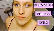 I WAS BORN WITH PURPLE EYES!