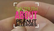 The Truth About Peanut Allergies | WebMD