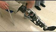 Bionic leg can 'read' brain signals to walk