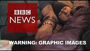 BBC goes undercover inside America's heroin epidemic - BBC News