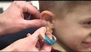 How To Insert An Earmold And Hearing Aid In A Child's Ear
