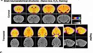 High-resolution micro-CT for 3D infarct characterization and segmentation in mice stroke models - Scientific Reports