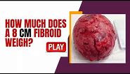How Much does a 8 CM Fibroid Weigh? [Watch-this]