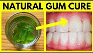 Best Mouthwash for Gum Disease – Cure Periodontal Disease & Gingivitis Natural Home Remedy Treatment