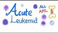 The Acute Leukemias