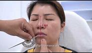 Measuring Facial Perfection Using Golden Ratio | An Educational Video by Radium Medical Aesthetics