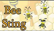 Bee sting - Symptoms and treatment; How to prevent death from Bee Sting?