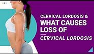Cervical Lordosis & What Causes Loss of Cervical Lordosis