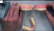 Case of the week: Highlighting the CAD/CAM Denture Process