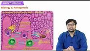 Lichen Planus (“Purple Skin Lesions”) Causes, Signs & Symptoms, Diagnosis, Treatment - Dermatology
