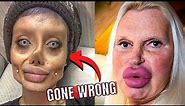 7 Times Plastic Surgery Went Horribly Wrong | Biggest Plastic Surgery Fails