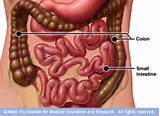 How To Pass Gas After Abdominal Surgery Pictures