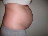 Very Low Abdominal Bloating Photos