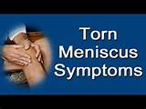 Torn Meniscus Symptoms Images