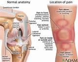 Knee And Back Pain Causes Pictures