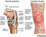 Photos of Cancer Knee Symptoms