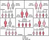 Inheritance Pattern Of Sickle Cell Anemia Pictures