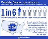 Prostate Cancer Treatment Types Photos