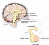 Pictures of Pituitary Tumor Webmd