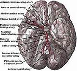 Images of Ischemic Brain Injury