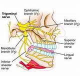 Photos of Headache Treatment San Francisco