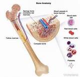 Symptoms Of Acute Lymphocytic Leukemia In Adults Images