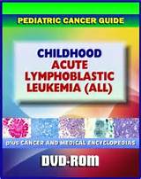 Pictures of Childhood Acute Lymphoblastic Leukemia Treatment