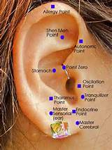 Migraine Headache Ear Pain Pictures