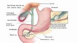 Images of Gallbladder Headache