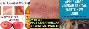 Apple Cider Vinegar Genital Warts