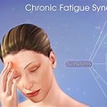 Chronic Fatigue Syndrome CFS