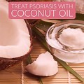 Coconut Oil Psoriasis Treatment