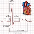 Normal Heart Beat ECG