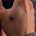 Peter Parker Spider Bite