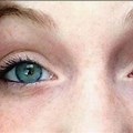 Rarest Human Eye Color