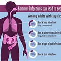 Sepsis Infection Symptoms